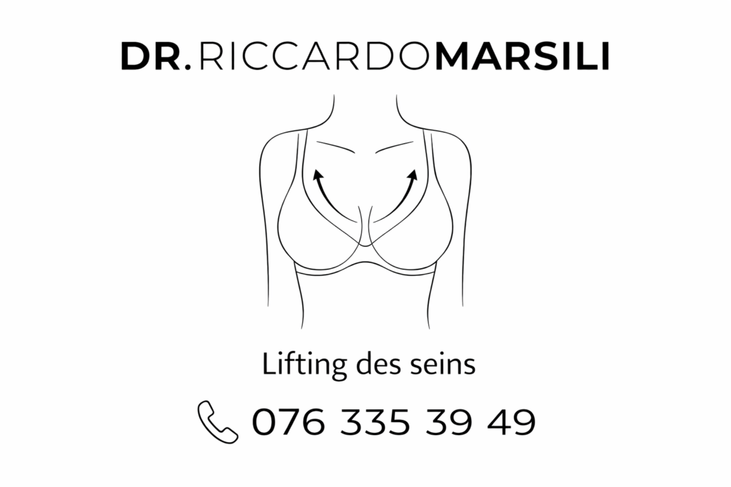 Lifting des seins sur Lausanne : FAQ informations