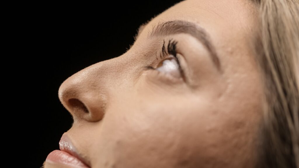 Rhinoplastie